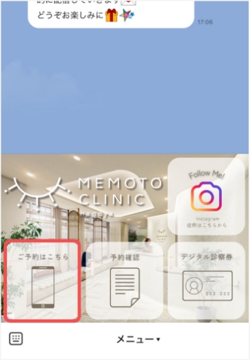 Step.02