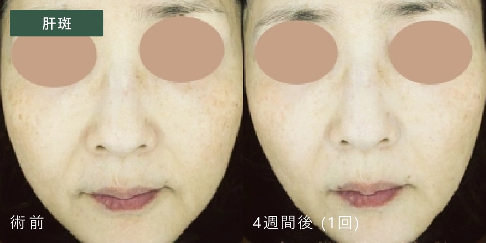 症例写真