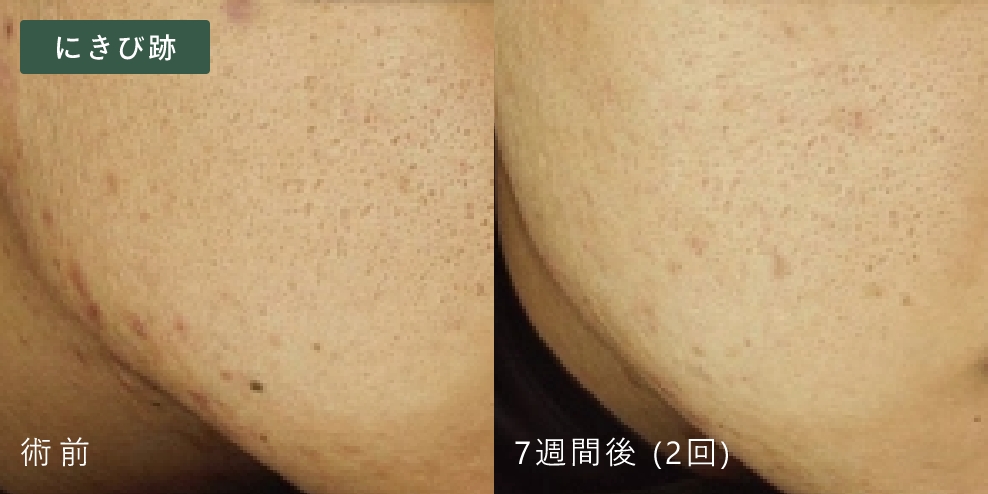 症例写真