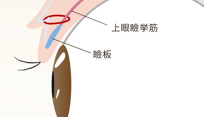 挙筋法