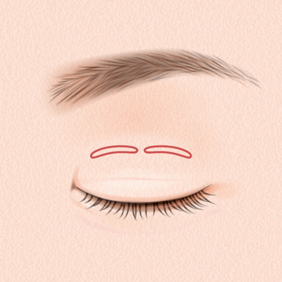 ダブルループ